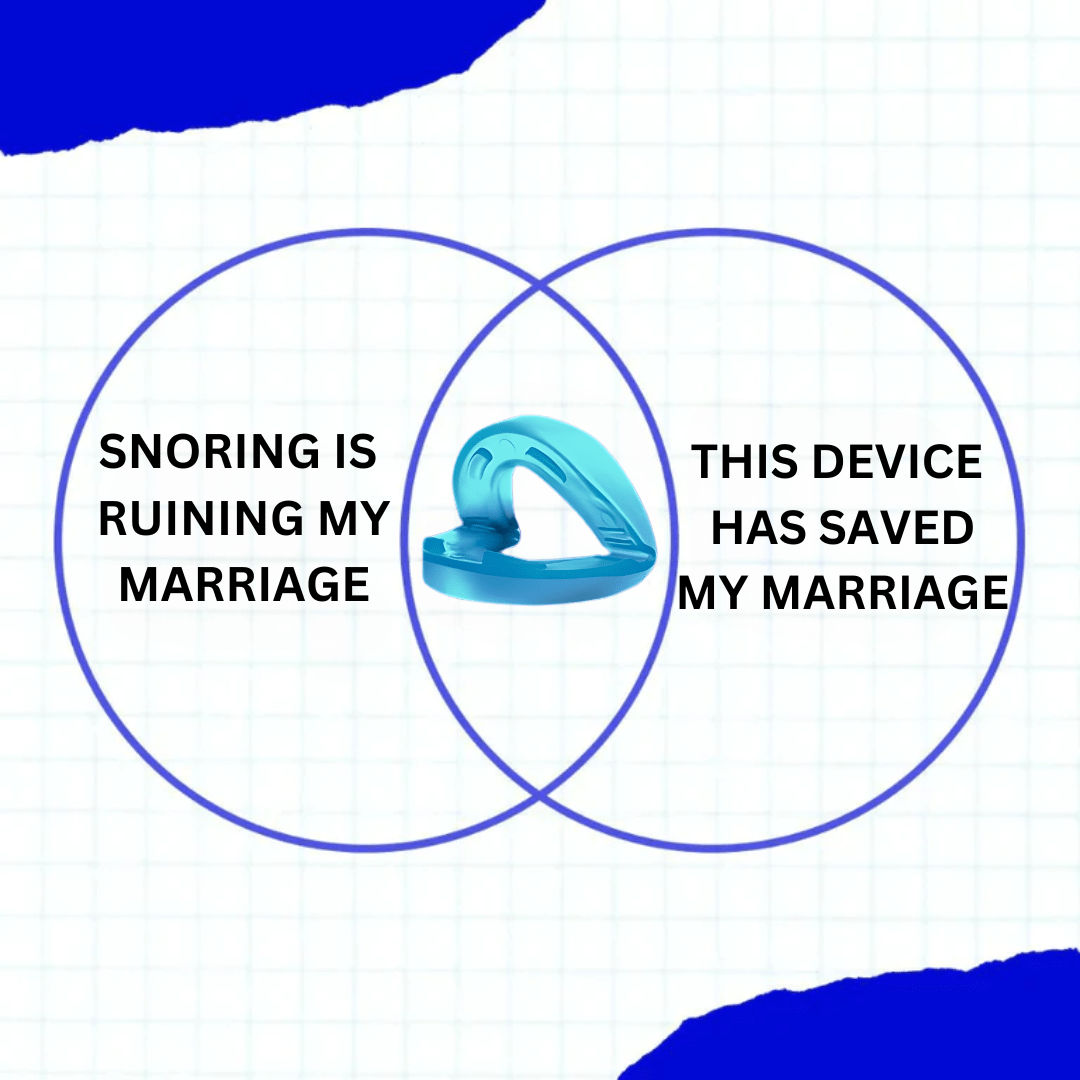 The Snorely Anti-Snoring Mouthpiece Universal Size